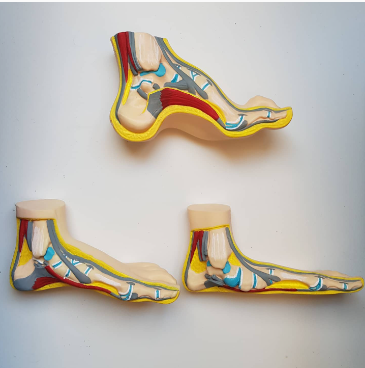 Orthotics-Related Pain: What Causes It and How to Stop It